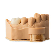 Dental Crown